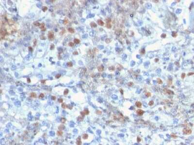 Immunohistochemistry-Paraffin: ROR gamma/RORC/NR1F3 Antibody (RORC/2941) [NBP3-08314] - Formalin-fixed, paraffin-embedded human kidney stained with ROR gamma/RORC/NR1F3 Mouse Monoclonal Antibody (RORC/2941).