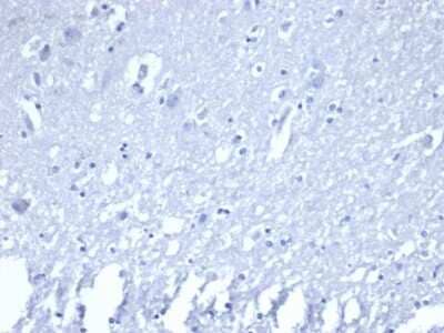 Immunohistochemistry-Paraffin: ROR gamma/RORC/NR1F3 Antibody (RORC/2941) [NBP3-08314] - IHC analysis of formalin-fixed, paraffin-embedded human brain. Negative tissue control using ROR gamma/RORC/NR1F3 antibody (RORC/2941) at 2ug/ml in PBS for 30min RT. HIER: Tris/EDTA, pH9.0, 45min. 2 : HRP-polymer, 30min. DAB, 5min.