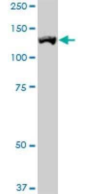 Western Blot: ROR1 Antibody (2F8) [H00004919-M01] - ROR1 monoclonal antibody (M01), clone 2F8. Western Blot analysis of ROR1 expression in HepG2 ( Cat # L019V1 ).