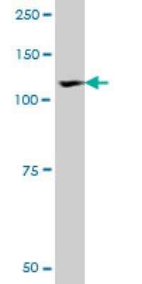 Western Blot: ROR1 Antibody (2F8) [H00004919-M01] - ROR1 monoclonal antibody (M01), clone 2F8. Western Blot analysis of ROR1 expression in MES-SA/Dx5 ( Cat # L021V1 ).