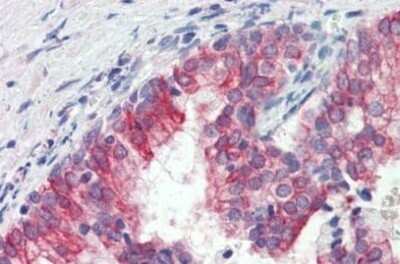 Immunohistochemistry-Paraffin: ROR1 Antibody [NBP1-52398] - Analysis of anti-ROR1 antibody with human prostate at concentration 3 ug/ml.