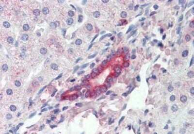 Immunohistochemistry-Paraffin: ROR1 Antibody [NBP1-52398] - Analysis of anti-ROR1 antibody with human liver at concentration 3 ug/ml.