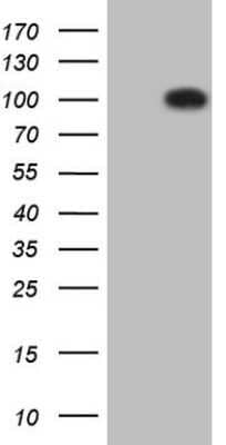 Western Blot: ROR1 Antibody (OTI3D11) - Azide and BSA Free [NBP2-73931] - Analysis of HEK293T cells were transfected with the pCMV6-ENTRY control (Left lane) or pCMV6-ENTRY ROR1 .