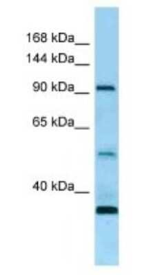 Western Blot: ROR1 Antibody [NBP1-98395] - Human Fetal Heart Lysate, concentration 1 ug/ml.