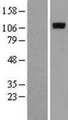 Western Blot: ROR1 Overexpression Lysate (Adult Normal) [NBL1-15477] Left-Empty vector transfected control cell lysate (HEK293 cell lysate); Right -Over-expression Lysate for ROR1.