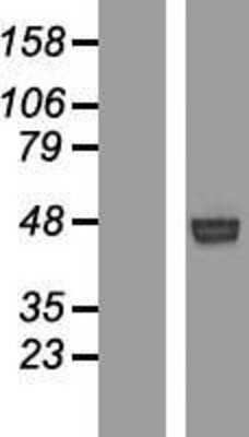 Western Blot: ROR1 Overexpression Lysate (Adult Normal) [NBP2-08430] Left-Empty vector transfected control cell lysate (HEK293 cell lysate); Right -Over-expression Lysate for ROR1.