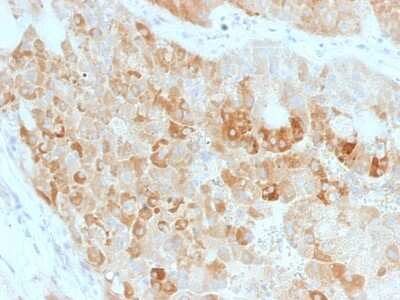 Immunohistochemistry-Paraffin: ROR2 Antibody (ROR2/1911) - Azide and BSA Free [NBP3-08532] - Formalin-fixed, paraffin-embedded human Kidney stained with ROR2 Mouse Monoclonal Antibody (ROR2/1911).