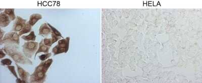 Immunohistochemistry: ROS Antibody (OTI1A1) - Azide and BSA Free [NBP2-73933] - Staining of HCC78 cells using anti-ROS1 mouse monoclonal antibody (Left). The right is HELA cells as negative control.