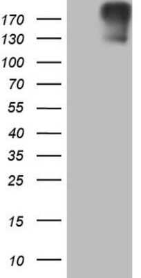 Western Blot: ROS Antibody (OTI1A1) - Azide and BSA Free [NBP2-73933] - Analysis of HEK293T cells were transfected with the pCMV6-ENTRY control (Left lane) or pCMV6-ENTRY ROS.