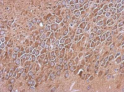 Immunohistochemistry-Paraffin: RP105 Antibody [NBP2-20205] - Immunohistochemical analysis of paraffin-embedded CL1-5 xenograft, using antibody at 1:500 dilution.
