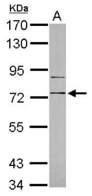 Western Blot: RP105 Antibody [NBP2-20205] - Sample (30 ug of whole cell lysate) A: HL-60 7. 5% SDS PAGE gel, diluted at 1:1000.