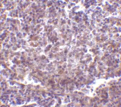 Immunohistochemistry-Paraffin: RP105/CD180 Antibody [NBP1-76706] - Human spleen tissue with RP105 antibody at 2 ug/ml.