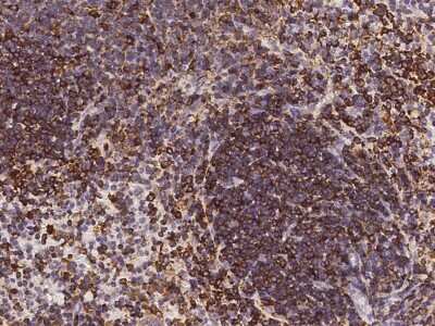 Immunohistochemistry-Paraffin: RP105/CD180 Antibody [NBP2-98285] - Staining of mouse RP105/CD180 in mouse spleen with rabbit polyclonal antibody (1:10000).