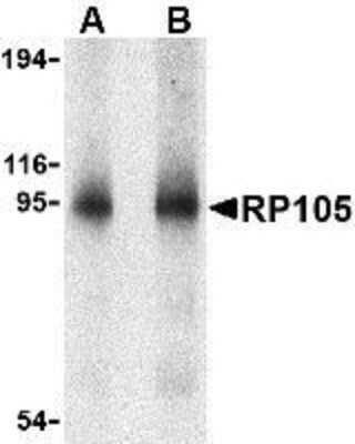 Western Blot: RP105/CD180 Antibody [NBP1-76706] - Human spleen tissue lysate with RP105 antibody at (A) 0.5 and (B) 1 ug/mL.