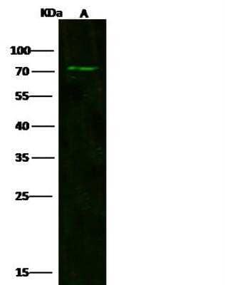 Western Blot: RP105/CD180 Antibody [NBP2-98285] - Lane A: HL-60 Whole Cell LysateLysates/proteins at 30 ug per lane.SecondaryGoat Anti-Rabbit IgG H&L (Dylight800) at 1/10000 dilution.Developed using the Odyssey technique.Performed under reducing conditions.Predicted band size:84 kDaObserved band size:70 kDa