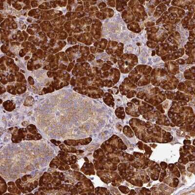 Immunohistochemistry ANKRD18A Antibody - BSA Free