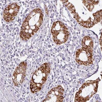 Immunohistochemistry ANKRD18A Antibody - BSA Free