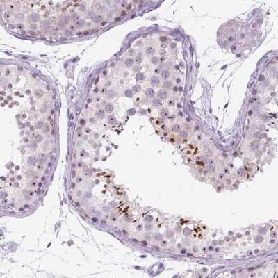 Immunohistochemistry-Paraffin RP11-195F19.5 Antibody - BSA Free