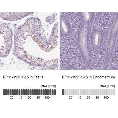 Immunohistochemistry-Paraffin RP11-195F19.5 Antibody - BSA Free
