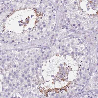 Immunohistochemistry-Paraffin: TCP11 Antibody [NBP2-14635] - Staining of human testis shows strong cytoplasmic positivity in subset of cells in seminiferus ducts.