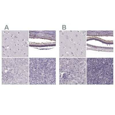 Immunohistochemistry-Paraffin: RP1L1 Antibody [NBP2-55240] - Staining of human cerebral cortex, eye, retina, liver and lymph node using Anti-RP1L1 antibody NBP2-55240 (A) shows similar protein distribution across tissues to independent antibody NBP2-55241 (B).