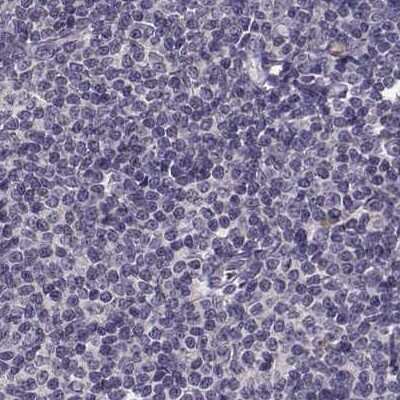 Immunohistochemistry-Paraffin: RP1L1 Antibody [NBP2-55241] - Staining of human lymph node.