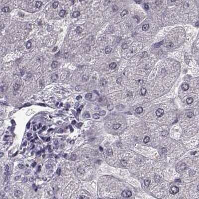 Immunohistochemistry-Paraffin: RP1L1 Antibody [NBP2-55241] - Staining of human liver.