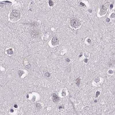 Immunohistochemistry-Paraffin: RP1L1 Antibody [NBP2-55241] - Staining of human cerebral cortex.