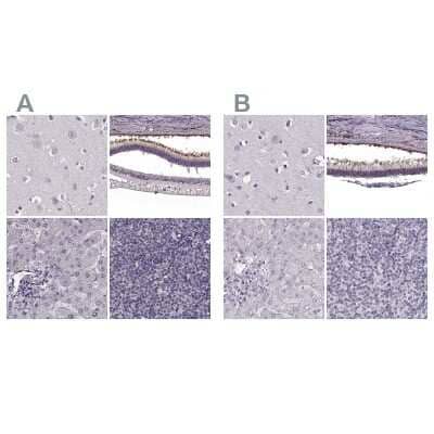 <b>Independent Antibodies Validation. </b>Immunohistochemistry-Paraffin: RP1L1 Antibody [NBP2-55241] - Staining of human cerebral cortex, eye, retina, liver and lymph node using Anti-RP1L1 antibody NBP2-55241 (A) shows similar protein distribution across tissues to independent antibody NBP2-55240 (B).