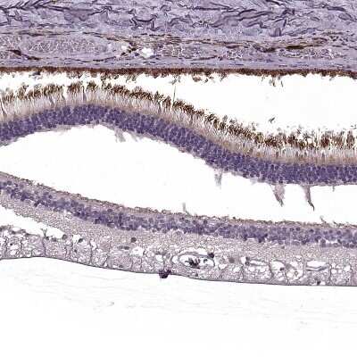 Immunohistochemistry-Paraffin: RP1L1 Antibody [NBP2-55241] - Staining of human eye, retina.