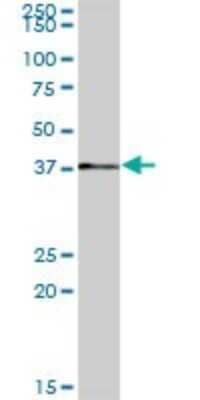 Western Blot: RP2 Antibody [H00006102-B01P] - Analysis of RP2 expression in human pancreas.