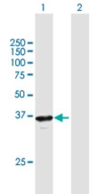 Western Blot: RP2 Antibody [H00006102-B01P] - Analysis of RP2 expression in transfected 293T cell line by RP2 polyclonal antibody.  Lane 1: RP2 transfected lysate(38.5 KDa). Lane 2: Non-transfected lysate.