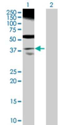 Western Blot: RP2 Antibody [H00006102-D01P] - Analysis of RP2 expression in transfected 293T cell line by RP2 polyclonal antibody.Lane 1: RP2 transfected lysate(39.60 KDa).Lane 2: Non-transfected lysate.