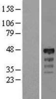 Western Blot: RP5-1077B9.4 Overexpression Lysate (Adult Normal) [NBL1-11887] Left-Empty vector transfected control cell lysate (HEK293 cell lysate); Right -Over-expression Lysate for RP5-1077B9.4.