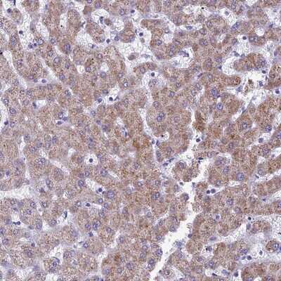 Immunohistochemistry-Paraffin: RP5-1077B9.4 Antibody [NBP1-87394] - Staining of human liver shows moderate cytoplasmic positivity in hepatocytes.