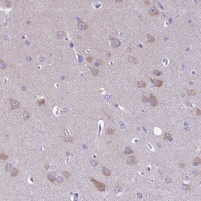 Immunohistochemistry-Paraffin: RP5-1077B9.4 Antibody [NBP1-87394] - Staining of human cerebral cortex shows moderate cytoplasmic positivity in neuronal cells.