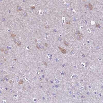 Immunohistochemistry-Paraffin: RP5-1077B9.4 Antibody [NBP1-87394] - Staining of human cerebral cortex shows weak to moderate cytoplasmic positivity in neuronal cells.