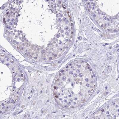 Immunohistochemistry-Paraffin: RP5-1077B9.4 Antibody [NBP1-87394] - Staining of human testis shows weak cytoplasmic positivity in spermatogonia.
