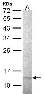 Western Blot: RPA14 Antibody (14.1) [NB100-160] - Sample (30 ug of whole cell lysate) A: Molt-4 15% SDS PAGE, antibody diluted at 1:500.