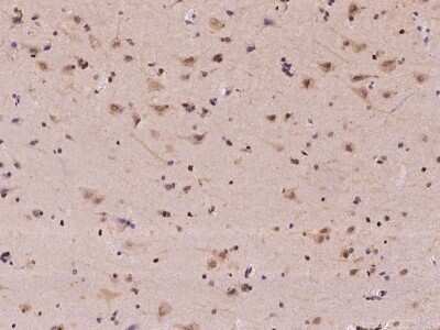 Immunohistochemistry-Paraffin: RPA14 Antibody [NBP2-97782] - Immunochemical staining of human RPA3 in human brain with rabbit polyclonal antibody at 1:100 dilution, formalin-fixed paraffin embedded sections.