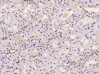 Immunohistochemistry-Paraffin: RPA14 Antibody [NBP2-97782] - Immunochemical staining of human RPA3 in human kidney with rabbit polyclonal antibody at 1:100 dilution, formalin-fixed paraffin embedded sections.