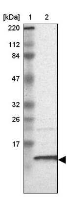 Western Blot: RPA14 Antibody [NBP1-87141] - Lane 1: Marker  [kDa] 220, 112, 84, 47, 32, 26, 17.  Lane 2: Human cell line RT-4