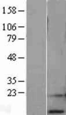 Western Blot: RPA14 Overexpression Lysate (Adult Normal) [NBL1-15490] Left-Empty vector transfected control cell lysate (HEK293 cell lysate); Right -Over-expression Lysate for RPA14.