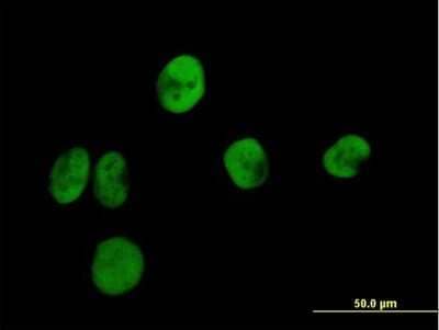 Immunocytochemistry/Immunofluorescence: RPA2 Antibody [H00006118-B01P] - Analysis of purified antibody to RPA2 on HeLa cell. (antibody concentration 10 ug/ml)