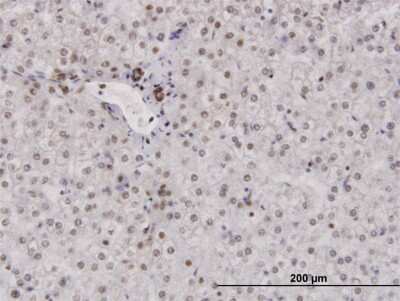 Immunohistochemistry-Paraffin: RPA2 Antibody [H00006118-B01P] - Analysis of purified antibody to RPA2 on formalin-fixed paraffin-embedded human liver. (antibody concentration 3 ug/ml)