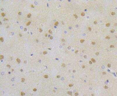 Immunohistochemistry: RPA2 Antibody (JE45-59) [NBP2-76888] - Immunohistochemical analysis of paraffin-embedded rat brain tissue using anti-RPA32/RPA2 antibody. The section was pre-treated using heat mediated antigen retrieval with Tris-EDTA buffer (pH 8.0-8.4) for 20 minutes. The tissues were blocked in 5% BSA for 30 minutes at room temperature, washed with ddH2O and PBS, and then probed with the antibody at 1/50 dilution, for 30 minutes at room temperature and detected using an HRP conjugated compact polymer system. DAB was used as the chrogen. Counter stained with hematoxylin and mounted with DPX.