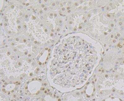 Immunohistochemistry: RPA2 Antibody (JE45-59) [NBP2-76888] - Immunohistochemical analysis of paraffin-embedded human kidney tissue using anti-RPA32/RPA2 antibody. The section was pre-treated using heat mediated antigen retrieval with Tris-EDTA buffer (pH 8.0-8.4) for 20 minutes. The tissues were blocked in 5% BSA for 30 minutes at room temperature, washed with ddH2O and PBS, and then probed with the antibody at 1/200 dilution, for 30 minutes at room temperature and detected using an HRP conjugated compact polymer system. DAB was used as the chrogen. Counter stained with hematoxylin and mounted with DPX.