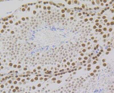 Immunohistochemistry: RPA2 Antibody (JE45-59) [NBP2-76888] - Immunohistochemical analysis of paraffin-embedded mouse testis tissue using anti-RPA32/RPA2 antibody. The section was pre-treated using heat mediated antigen retrieval with Tris-EDTA buffer (pH 8.0-8.4) for 20 minutes. The tissues were blocked in 5% BSA for 30 minutes at room temperature, washed with ddH2O and PBS, and then probed with the antibody at 1/200 dilution, for 30 minutes at room temperature and detected using an HRP conjugated compact polymer system. DAB was used as the chrogen. Counter stained with hematoxylin and mounted with DPX.