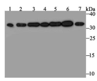 Western Blot: RPA2 Antibody (JE45-59) [NBP2-76888] - Western blot analysis of RPA32/RPA2 on different lysates. Proteins were transferred to a PVDF membrane and blocked with 5% BSA in PBS for 1 hour at room temperature. The primary antibody was used at a 1:500 dilution in 5% BSA at room temperature for 2 hours. Goat Anti-Rabbit IgG - HRP Secondary Antibody at 1:5,000 dilution was used for 1 hour at room temperature.Positive control:Lane 1: Mouse testis tissue lysateLane 2: A431 cell lysateLane 3: SH-SY-5Y cell lysateLane 4: SiHa cell lysateLane 5: 293 cell lysateLane 6: Hela cell lysateLane 7: HepG2 cell lysate