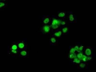 Immunocytochemistry/Immunofluorescence: RPA2 Antibody (OTI9A1) - Azide and BSA Free [NBP2-73935] - Staining of COS7 cells transiently transfected by pCMV6-ENTRY RPA2.